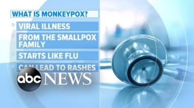 1st US case of monkeypox confirmed in Massachusetts