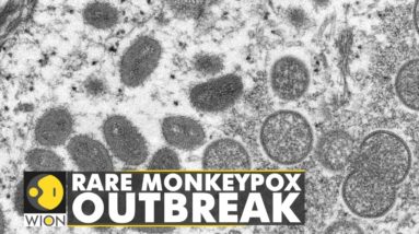 Rare monkeypox outbreak: The US reports the first case of monkeypox | Britain reports 10 cases