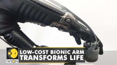 Low-cost Bionic arm transforms lives, helps attain basic mobility | World Latest News | WION