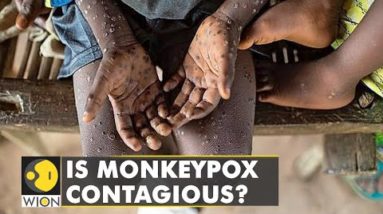 Panic vs Prevention: Should we worry about Monkeypox outbreak? | World News | WION