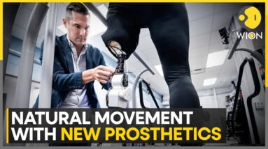 New surgery enhances prosthetic limb control | Latest English News | WION